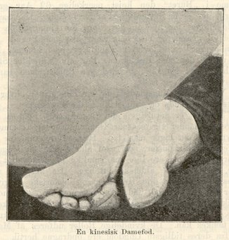 En kinesisk damefod