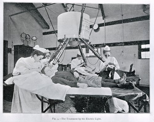 Finsens lysterapi i brug ved London Hospital
